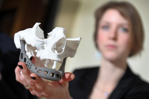 Doctor Ingeborg van Kroonenburgh, from the Maastrich university, shows the printed lower jaw during a a press conference on February 2, 2012 at the Hasselt Biomed universtiy campus in Diepenbeek. An artificial jaw using innovative 3D innovative technology has been successfully implanted into a Dutch woman suffering from a serious jaw infection, enabling her to speak again, the Belgian-Dutch eam announced. A custom jaw was developed by the Biomed Functional Morphology research group for the Dutch patient. The price of the 107-gram prothesis is around 9,000 Euros. AFP PHOTO / BELGA - YORICK JANSENS